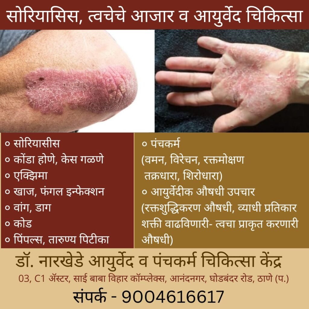 Ayurvedic treatment for skin problems